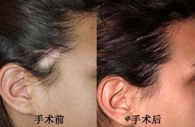 �̺���ֲ����