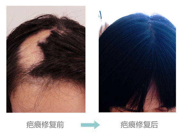 �̺��ѷ����ܽ���ֲ����