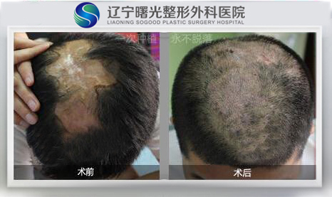 �̺���ֲ�ķ��ո���?