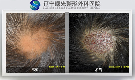 �̺��ѷ������κ���