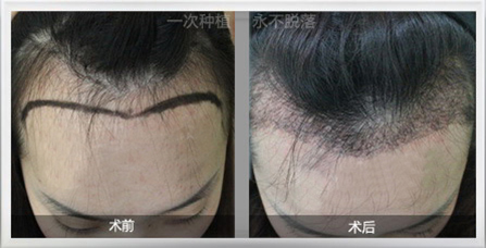 ��������ֲ