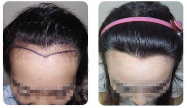 �����߸���ô��