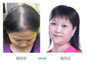 Ů����������߸���ô��