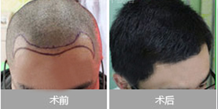 �����߻�ı�������