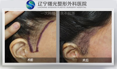 ��������ֲ����