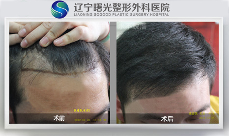 ��ͷ�����߸���ô��