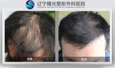 ֲ��ʧ�ܸ���ô�죿