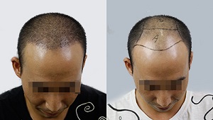 ë����ֲ����Ч�����ܳ�����