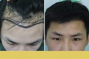 ������ë����ֲ����Ч������