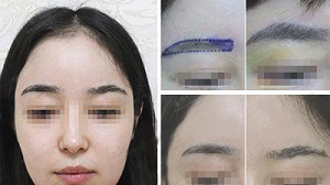 ��ֲüë�ļ���Ч����ʵ��Ȼ��