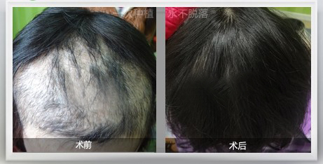 ֲ��һ�ζ���Ǯ