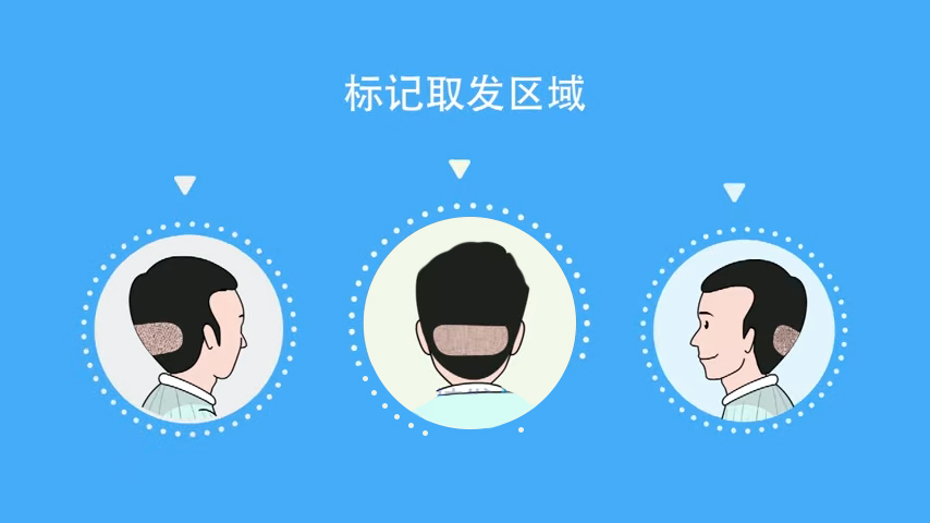 ͷ��������ͷƤм����ô��