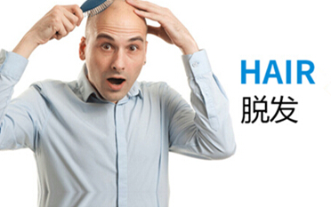 脱发怎么回事